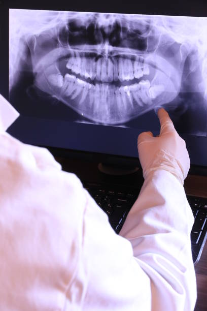 Best Emergency Treatment for Dental Infections or Abscesses in , GA